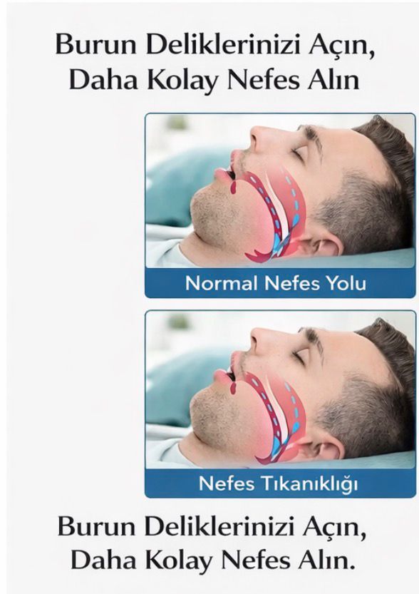 Horlama ve Burun Tıkanıklığı Karşıtı Burun Bandı