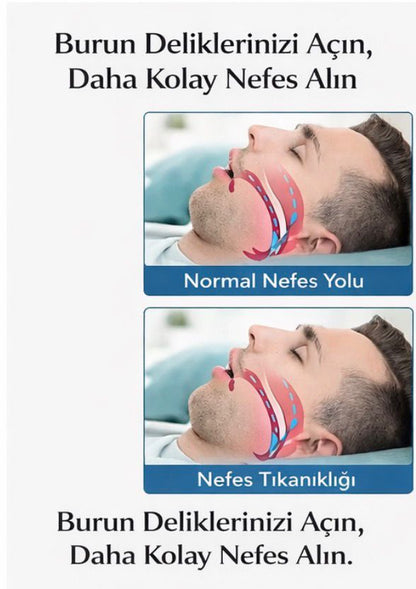 Horlama ve Burun Tıkanıklığı Karşıtı Burun Bandı